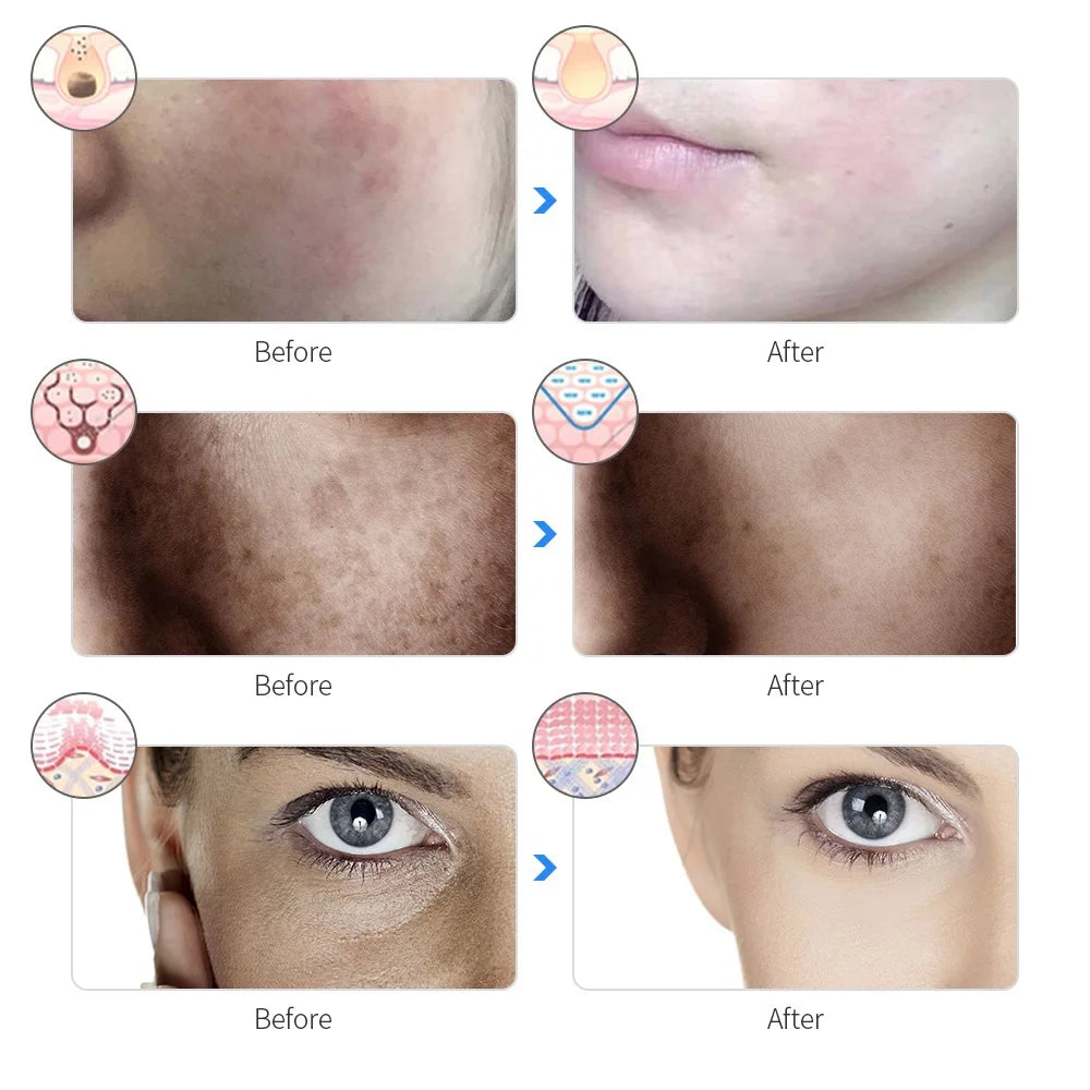 LumiMask Pro — 7-Color LED Photon Face Mask