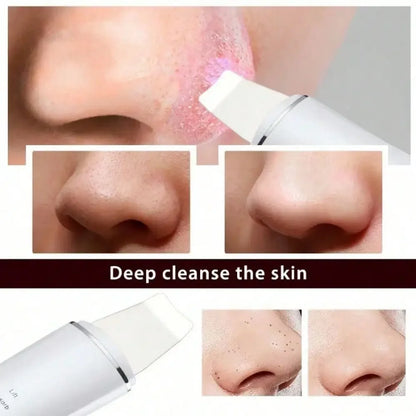 LumiClear Pro — EMS Ultrasonic Skin Scrubber & Pore Cleanser